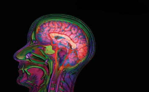 Engaging your mind