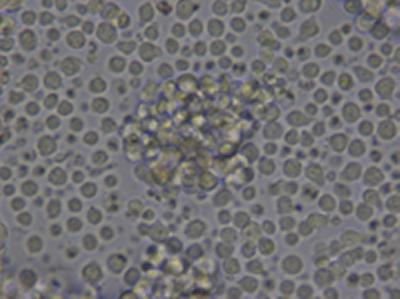 Our scientists are to explore ways of preventing life-threatening side effects in patients receiving bone marrow transplants
