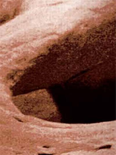 Could lead to new bone repair therapies and help people with bone fractures or osteoporosis