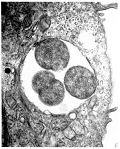 Within the cell there is four chlamydia