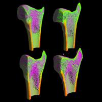 4 Stained femur cross sections