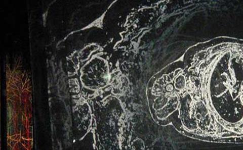 Image Andrew Carnie's investigation into the human brain
