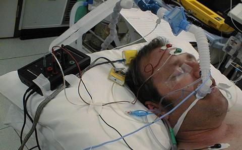 Depth of anaesthesia
