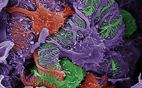Kidney podocytes
