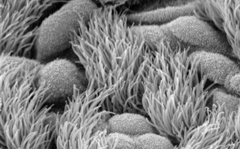 Image of ciliated airway cells