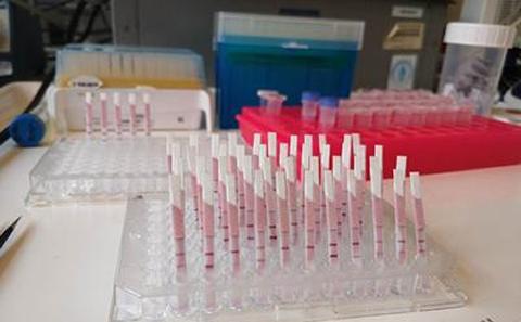 Diagnostic test