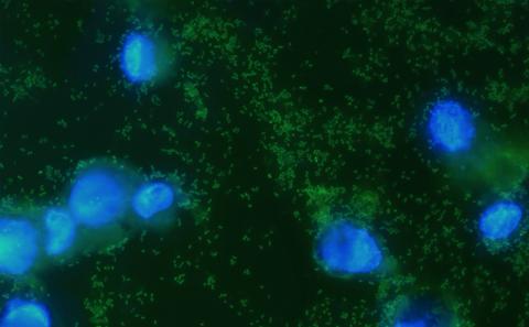 Respiratory tract pathogen infecting macrophages