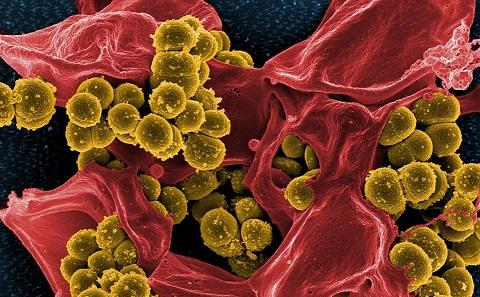 Superbug
