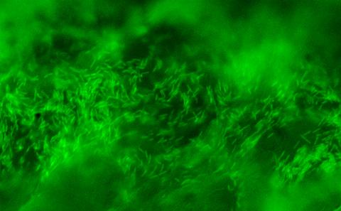 Bacteria on wound