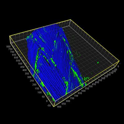 Confocal microscopy of surgical suture and biofilms