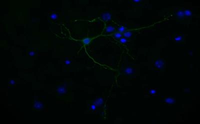 Corticol neurons transfected with the RNA binding protein FXR2 flag and detected by probing with α-FLAG 1˚ and AlexaFluor 488 2˚  antibodies