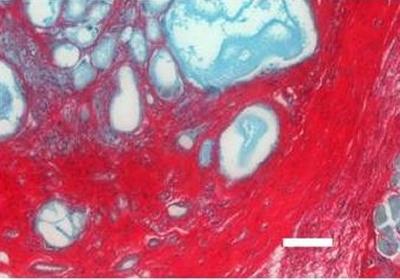 In vivo bone formation as evidenced by Sirius red stain for new collagenous matrix