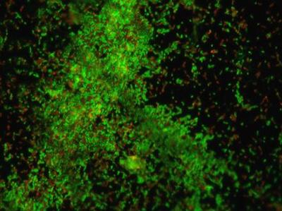 Live/dead staining of a 48 hour old L. monocytogenes biofilm