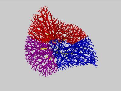 Pulmonary vessels, coloured by bronchopulmonary segment, for the right upper lobe