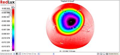 RedLux Image of a Retrieved Femoral Head Showing a Wear Scar on the Bearing Surface