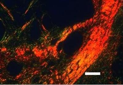Polarized light birefringence for new collagen