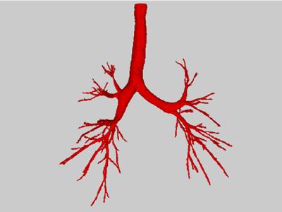 Human airway tree, showing the airway branches down to around the 6th generation