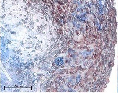 Cartilaginous explants of chondrocytic cells cultured on fibres of Polyglycolic acid fleece