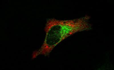 Confocal image of mRNA and proteins of the potassium leak channel Task3. HeLa cells transfected with Task3-GFP. Task-GFP mRNA detected by FISH using anti-GFP Stellaris