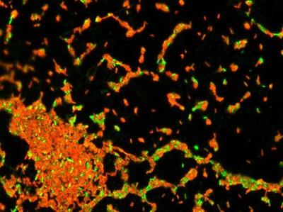 Live/dead staining of a 24 hour old L. monocytogenes biofilm 