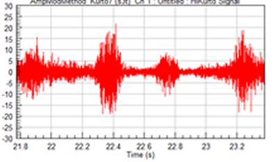 Burst non-Gaussian test signal  Graph