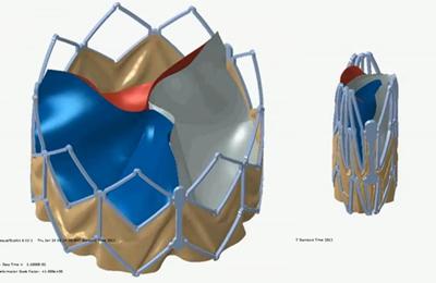 Artifical heart valves are increasingly being deployed as replacements.