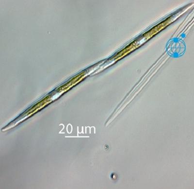 Alexandra pseudonitz