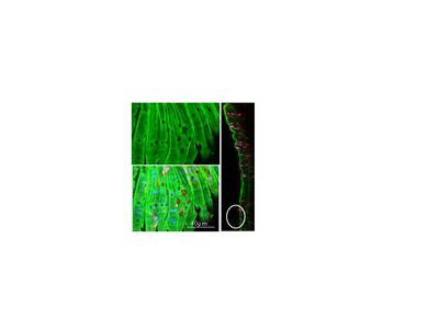 Confocal image of a myoendothelial gap junction co-localised with the intermediate Ca 2+-dependent K+-channel KCa3.1(IK1) from a resistance artery of the mouse