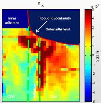 Strain concentrations