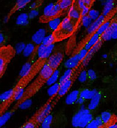 Skeletal muscle ALMS1