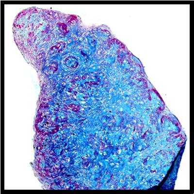 Cells extracted from the knee are grown as a levitated pellet to enhance the formation of new cartilage for subsequent transplants (image: S. Li)