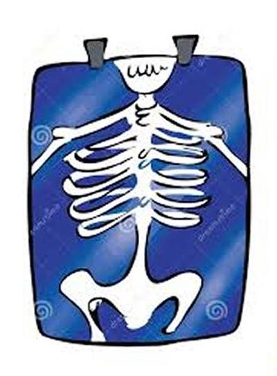 chest x-ray
