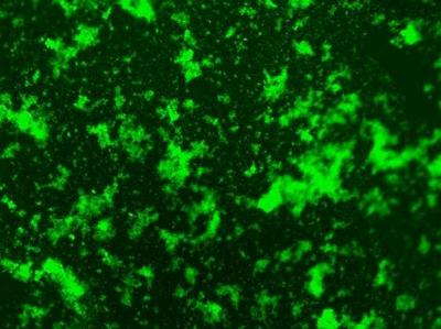Epi-fluorescent DNA staining of Proteus Mirabilis Biofilm