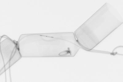 pull a Christmas cracker during live radiography