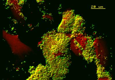 Image of Gonococci