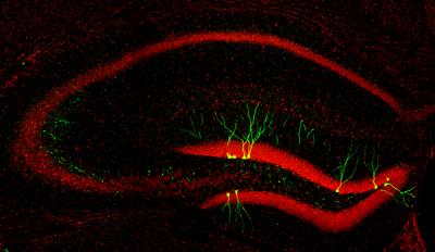 Their connections can be identified by using retroviral vectors encoding a green fluorescent protein (Venus). Cell nuclei are labelled in red (Topro3)