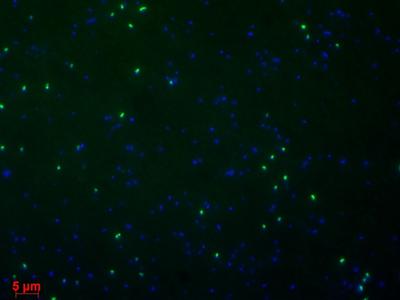Epiflourescence micrographs