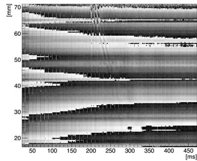 Transient 1D waves in the left ventricle of a healthy volunteer 