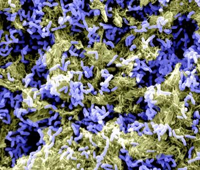 Biofilm on orthopaedic implant material