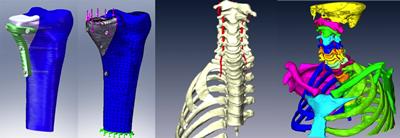 Anatomical bone models