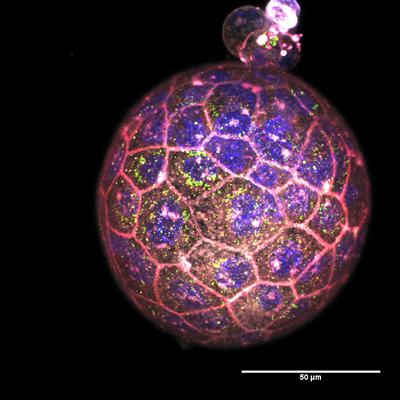 Blastocyst