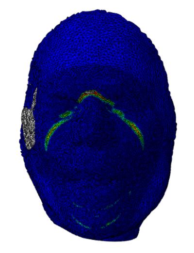 FEA Mask