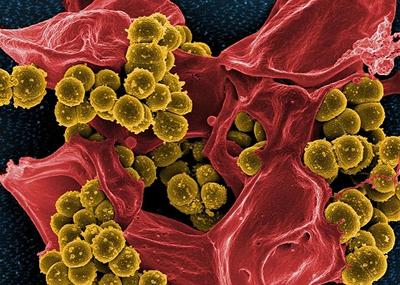 Image of germ