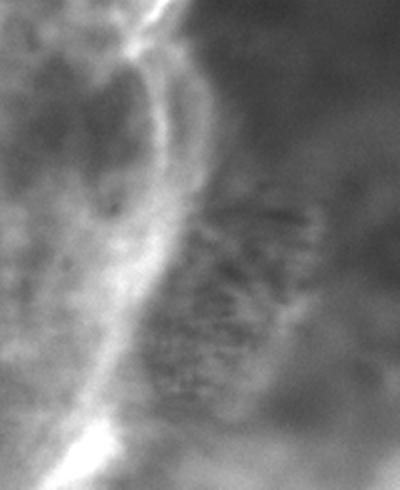 Ciliated cells