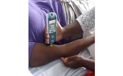 Myoton device