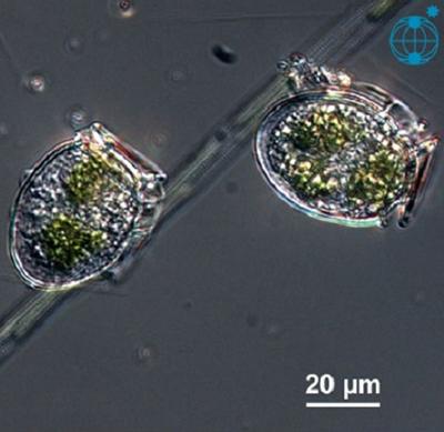 Dinophysis