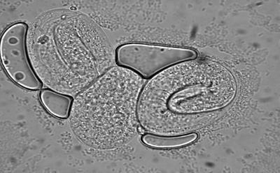 Nematode