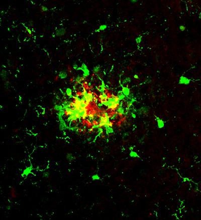 Microglial cells expressing high levels of CSF1R (green) around Amyloid Beta plaques (red)