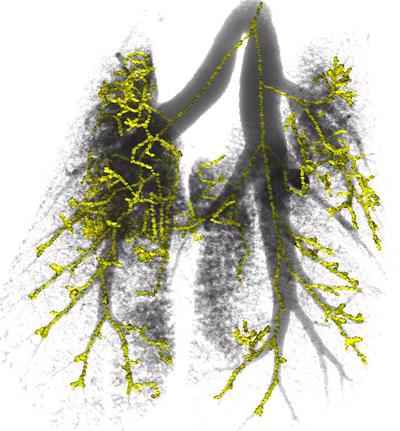 Mouse Lungs