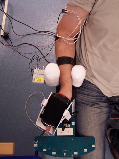 Wrist EMG Testing